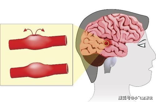 前夫求爱记 前夫求爱记全集免费观看完整版 前夫求爱记 前夫求爱记全集免费观看完整版