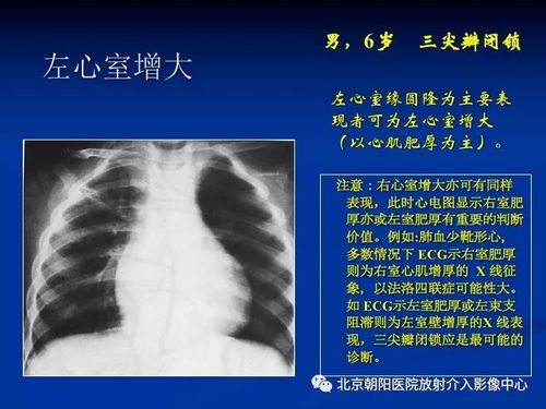 a����Ѫ�ܼв㱣������