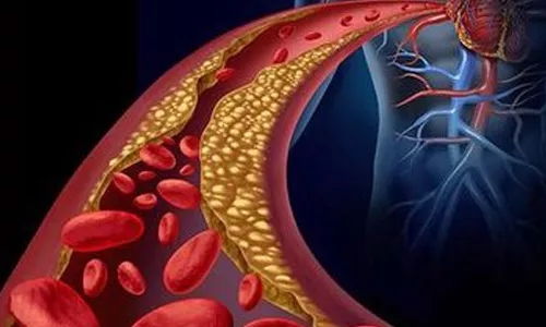 �Ⱦƺ������ӿ���ʲôԭ��