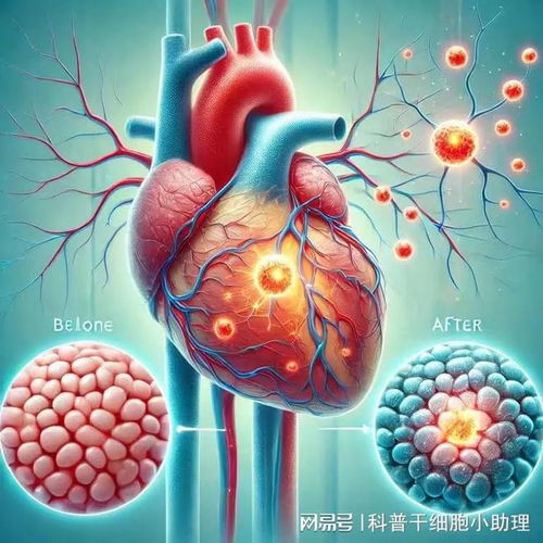 印度的心脏病毒咋样 印度有心脏病 印度的心脏病毒咋样 印度有心脏病