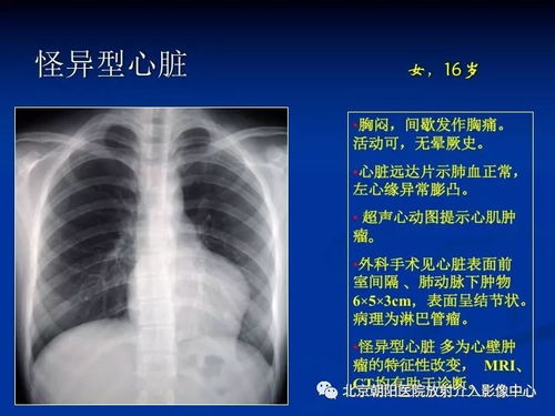 ��Ѫ�ܷ��ֳ�ʲôҩ���