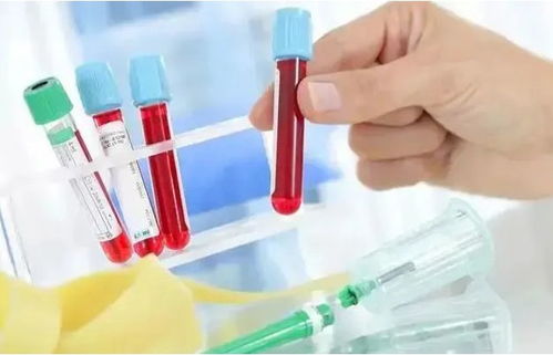 �к���Ѫ�ܵ�ʳ���ˮ��