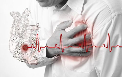 冠心病的造影表现 冠心病造影怎样做疼吗 冠心病的造影表现 冠心病造影怎样做疼吗