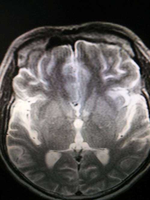 Ѫ��������ȫ��Ѫ