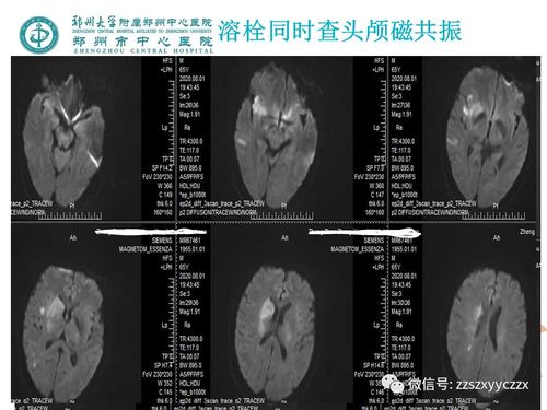 妃英理和工藤有希子妃英理打工藤新一的头哪一集 妃英理和工藤有希子妃英理打工藤新一的头哪一集