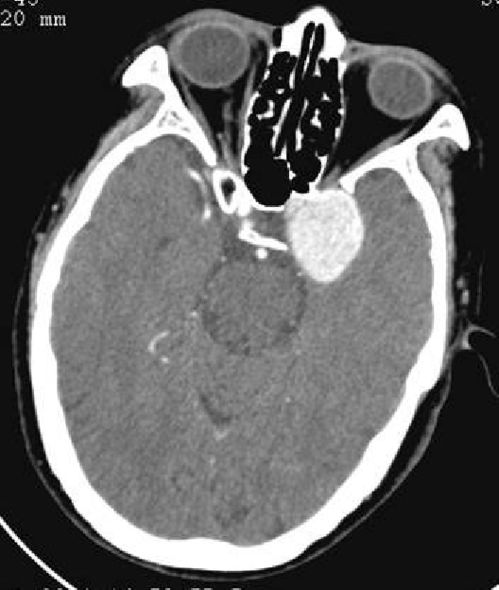 胎儿出生时心脏长全了吗 胎儿出生时心脏长全了吗