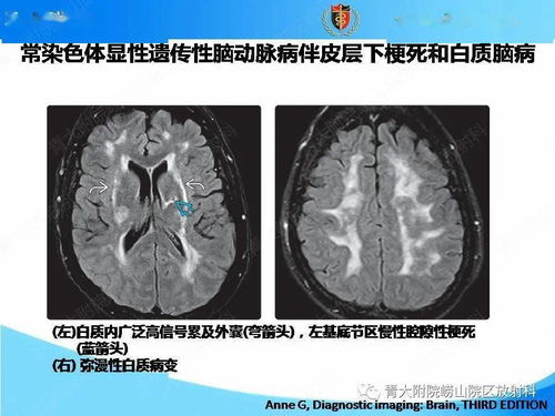 陈百祥搞笑电影 陈百祥搞笑电影合集 陈百祥搞笑电影 陈百祥搞笑电影合集