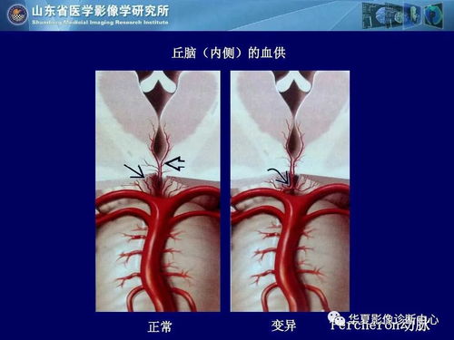 冠心病病人黑色大便冠心病病人黑色大便怎么回事 冠心病病人黑色大便冠心病病人黑色大便怎么回事