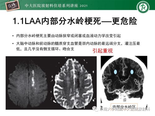 心血管气血不足怎么调理 心血管气血不足怎么调理