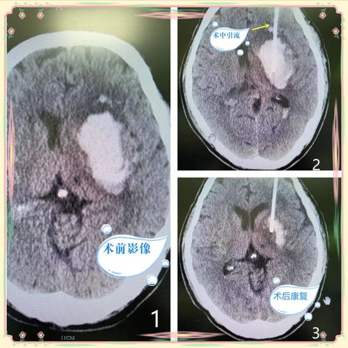 中年男士吃什么对心脏好 中年男士吃什么对心脏好