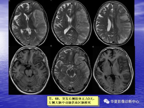 手工元宵的做法(手工元宵的制作过程视频) 手工元宵的做法(手工元宵的制作过程视频)