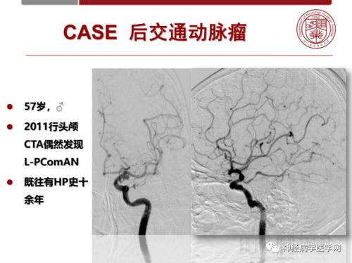 分数的加减法题五年级下册(分数加减法练习题五年级下册) 分数的加减法题五年级下册(分数加减法练习题五年级下册)
