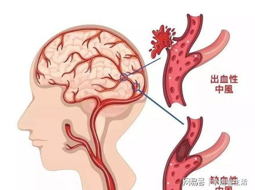 心脏彩超ti是啥_心脏彩超tee 心脏彩超ti是啥_心脏彩超tee