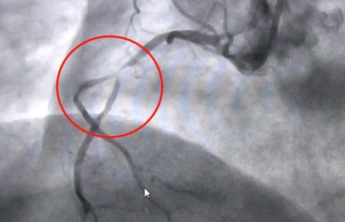 吕一身高真实身高多少 吕一身高真实身高多少