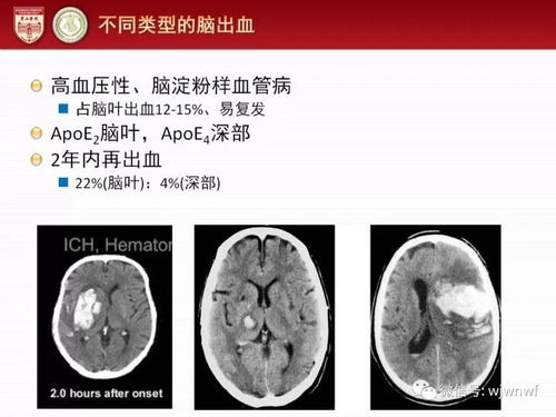 有高血压能吃补血东西吗 有高血压能吃补血东西吗