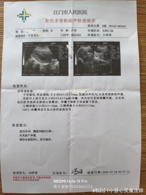 海贼王漫画1020 海贼王漫画1017话什么时候更新 海贼王漫画1020 海贼王漫画1017话什么时候更新