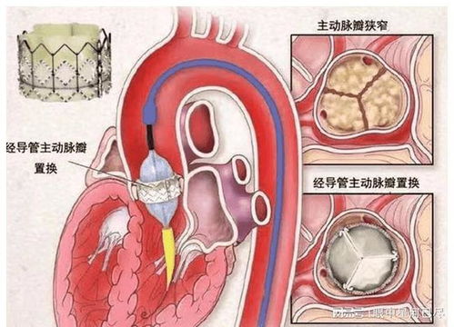 秦奋和贾青在一起过吗 秦奋和贾青在一起过吗