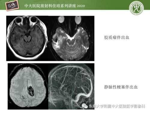 ȿȻѪѹ ȿȻѪѹΪʲô