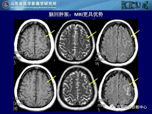 北京466医院骨科(北京466医院骨科电话) 北京466医院骨科(北京466医院骨科电话)