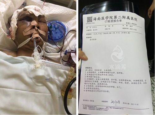 颌下淋巴结肿大是怎么引起 颌下淋巴结肿大是怎么引起